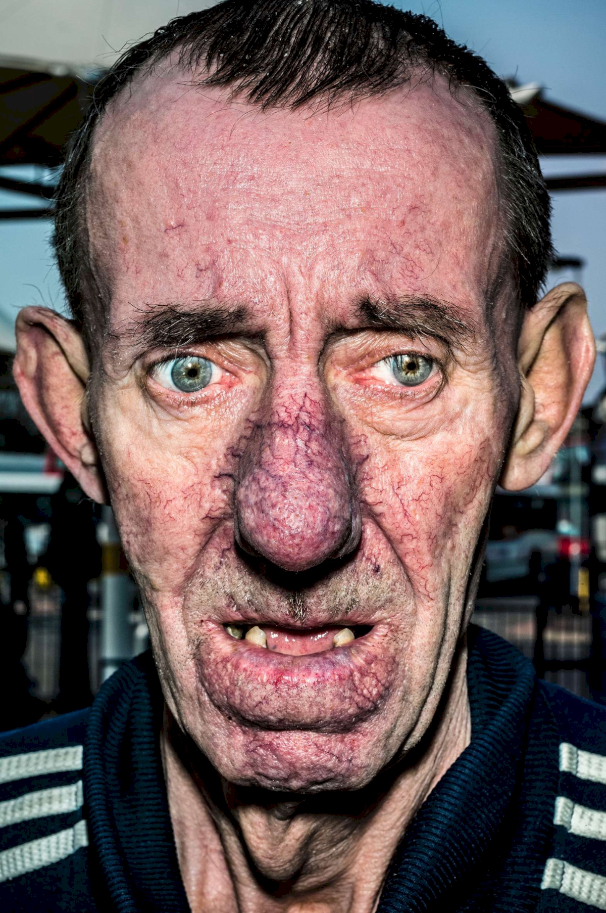 Peter, West Bromwich, Great Britain, 2014. © Bruce Gilden / Magnum Photos
